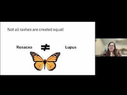Blum Center Program: Lupus - An Evolving Landscape