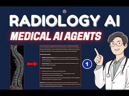 Radiology AI Project: Part 1 (Setup Open Source LLM)