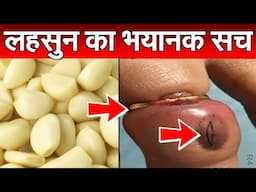 खाली पेट लहसुन खाने के बाद, देखिये आपके शरीर के साथ क्या होता है | शरीर बनेगा फौलाद 4|Roshan Zindagi