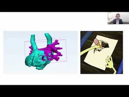 RSNA 3D SIG Webinar - Immersive Reality Mini-Lecture Series - #1