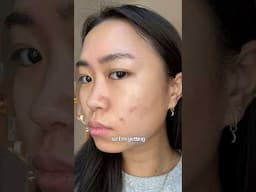 Drop all your tips/advice please! Pt. 2 of my adult acne to clear skin journey, on my new routine!