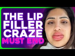 Women Are Removing Lip Filler in SHOCKING Numbers