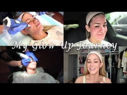 GLOW UP SERIES | Road To The Wedding: I get Microneedling done! | Ep. 1