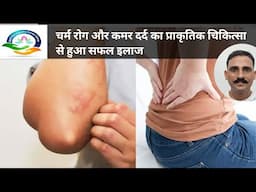 चर्म रोग | एलर्जी । कमर दर्द | में प्राकृतिक उपचार से मिला आराम । BKN नेचरोपेथी ।