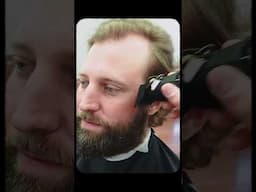 Thinning hair isn’t the end. You’ve got options.