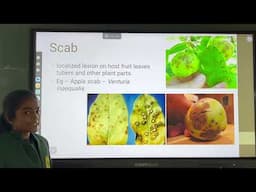 PATh171, Lec63. Common symptoms of fungal diseases by Sameera Nashrin Sk