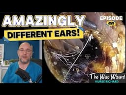 AMAZINGLY DIFFERENT EARS! Episode 459