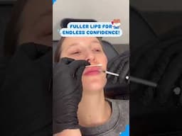 Fuller Lips for Endless Confidence