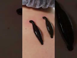 You Can Still be Prescribed Leeches | Fascinating Horror Shorts