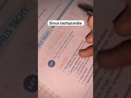 What is simus tachycardia #nursing #nclexprep #ecg #ecgreading