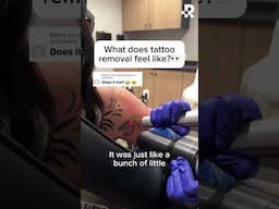 Does tattoo removal hurt? #removery #tattooremoval