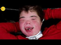 Living with One of the Rarest Conditions Ever (Brody's Battle)
