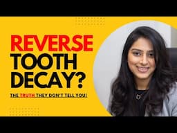 Reverse Tooth Decay? The TRUTH they don't tell you about Healing Cavities Naturally - Dentist Shares