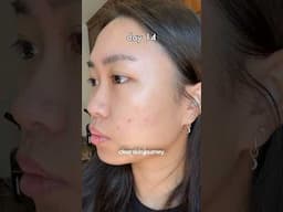 2 week update of my adult acne to clear skin journey! Trying to cut down on dairy is hard 🥲