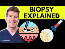 What is a Biopsy? Doctor explains procedure, purpose, results & more