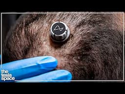 Neuralink Reveals Another New Human Patient!