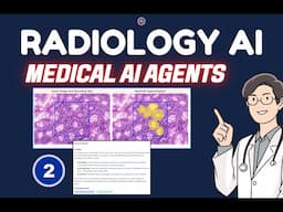 Radiology AI Project: Part 2 (Segmentation & Entity Extraction)