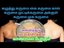 Remove Dark spots, pigmentation, dark neck remedy / Skin Brightening mask / Potato Face Mask
