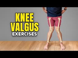 Knock Knee Exercises (Knee Valgus)