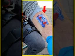 This Clamp Can Stop Bleeding!! 🤯🤯 #new #yt #youtubeshorts #doctor