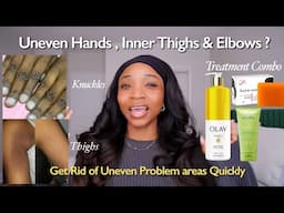 So you have uneven skintone ! |This Treatment Combo will blend darker neck, knuckles Quickly.