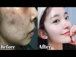 Ancient Japanese Beauty Secrets: Clear Skin & No more Dark Circles And pimples Natural Glow Revealed