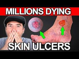 SKIN ULCERS That WON'T HEAL - 5 Steps to REGENERATE Varicose Ulcers PERMANENTLY