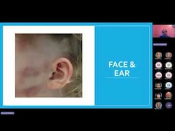 Do Not Miss It - Recognizing Abuse - Pediatric Grand Rounds Meeting Recording 4 18 25