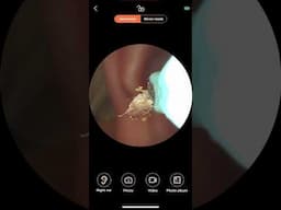 Xiaomi Soulear Ear Wax Cleaner with Camera