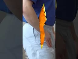 Tight Psoas Muscle