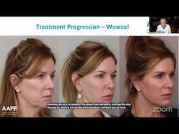 NEW AAFE Top 4 Must See Botox Treatments For 2025