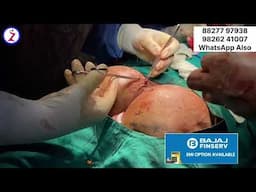 Buttocks implant surgery in mumbai kolkata lucknow Hyderabad Bangalore indore chandigarh Ahmedabad