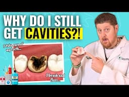 Why You’re Getting Cavities Even with Perfect Dental Care