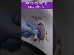 CBC टेस्ट कैसे होता है?