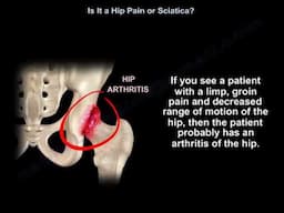 Is My Pain from the Hip or the Spine?