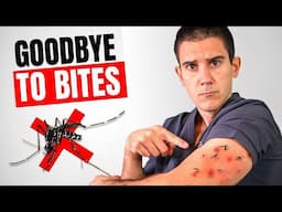 How to Get Rid of Mosquito Bites FAST (Try THIS)