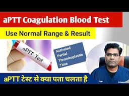 aPTT test kya hai | Activated Partial Thromboplastin Time | Coagulation Test | aPTT Use..
