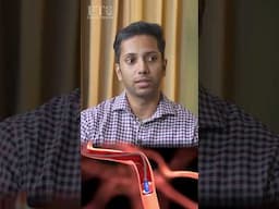 The significant benefit of mechanical thrombectomy - Dr. Bibin Sebastian
