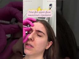 Time for Upper Face Neurotoxin Injections