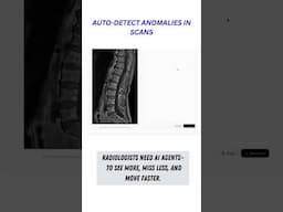 AI Agents for Radiologists. Healthcare AI.#ai #shorts #youtubeshorts #healthcare #healthcareai