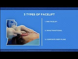 Facelift Types Explained: Mini, SMAS/Traditional, and Deep Plane Facelifts