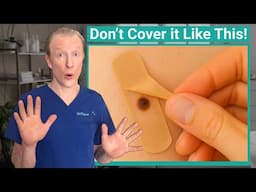 Covering Moles in the Sun? Here’s What You Need to Know