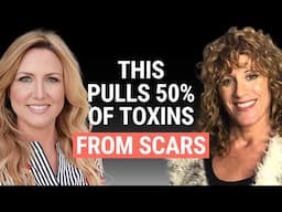 Detox Scars, Surgeries, and Dental Work With Mud Packing and Castor Oil | Julie EHealth