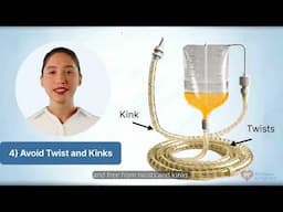 Hospital Acquired Condition - Catheter Associated Urinary Tract Infection (CAUTI)