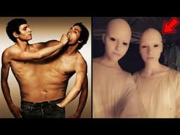 10 Most Unusual Twins In The World