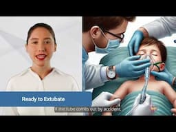 Hospital Acquired Condition - Extubation