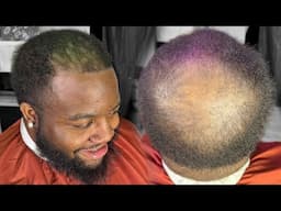 FIXING His BALDING HEAD Was NOT A Easy TASK!
