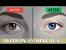 Aankhon Ka Rang Badalne Ka Permanent Tarika | Eye Colour Change | Keratopigmentation | Eye Drop