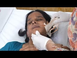 REMOVING JAW PACKING AFTER 7TH DAY