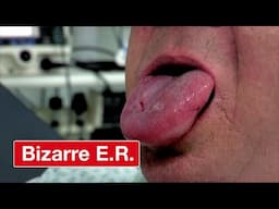 Man Swallows Wasp And Gets Stung On Tongue - Bizarre ER